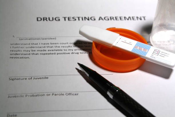 Drug Testing Agreement