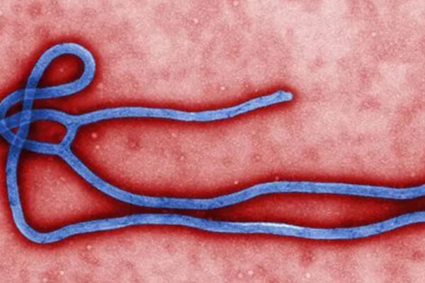 Ebola Outbreak Kills 100 in DR Congo