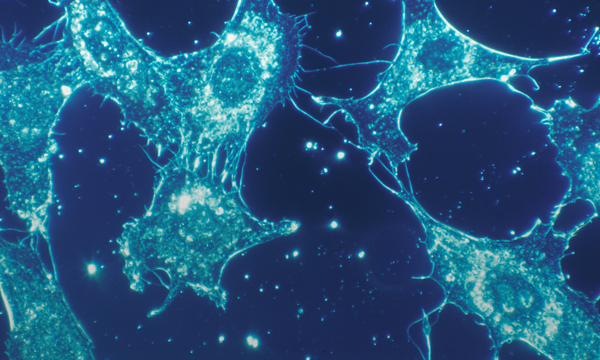 Cancer In Nigeria: The Disease, The Delays and The Cost of Finding Out Too Late