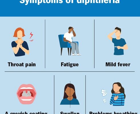 Plateau Records 469 Diphtheria Cases, 31 Deaths