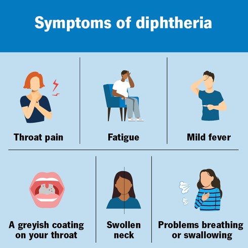 Plateau Records 469 Diphtheria Cases, 31 Deaths