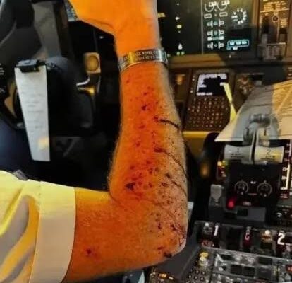 Horror in the Sky: Flight FZ1073 Diverted After Midair Attack