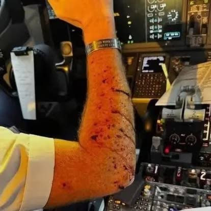 Horror in the Sky: Flight FZ1073 Diverted After Midair Attack