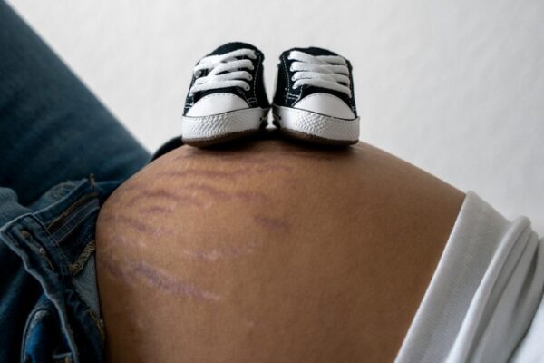 The Quiet Medical Crisis Claiming Young Women’s Lives